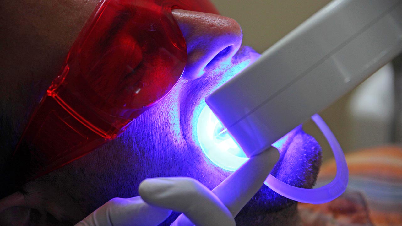 Patient undergoing whitening treatment
